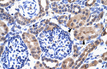 SIRT3 Rabbit Polyclonal Antibody