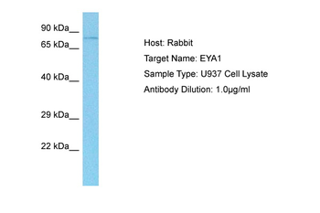 EYA1 Rabbit Polyclonal Antibody