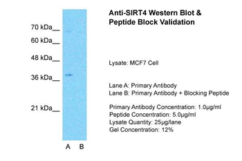 SIRT4 Rabbit Polyclonal Antibody