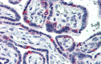 SIN3A Rabbit Polyclonal Antibody