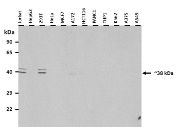 SPDEF Rabbit Polyclonal Antibody