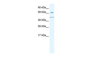 AIRE Rabbit Polyclonal Antibody