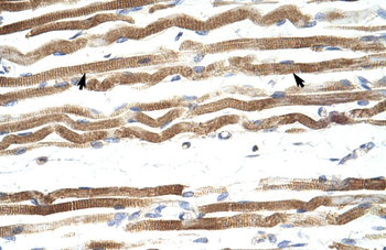 NFATC4 Rabbit Polyclonal Antibody