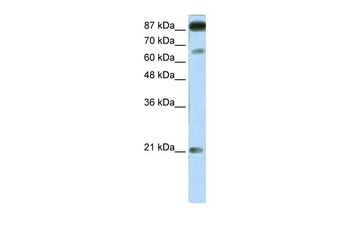 NFATC4 Rabbit Polyclonal Antibody