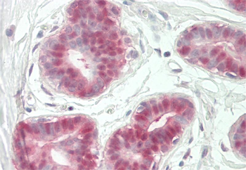 NR4A2 Rabbit Polyclonal Antibody