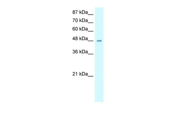 HMG20A Rabbit Polyclonal Antibody