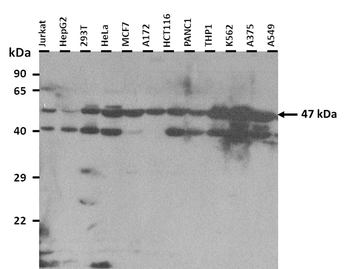 ACADM Rabbit Polyclonal Antibody