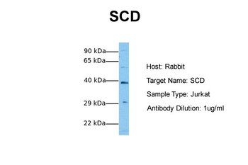 SCD Rabbit Polyclonal Antibody
