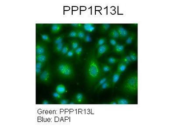PPP1R13L Rabbit Polyclonal Antibody