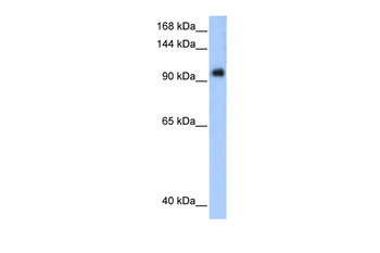 PPP1R13L Rabbit Polyclonal Antibody