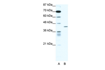 PPARD Rabbit Polyclonal Antibody