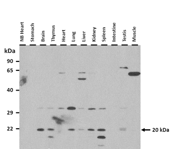 Arpc4 Rabbit Polyclonal Antibody