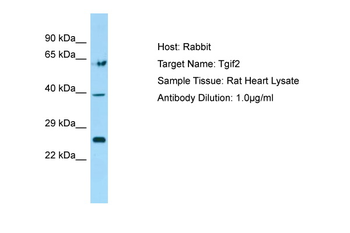 Tgif2 Rabbit Polyclonal Antibody