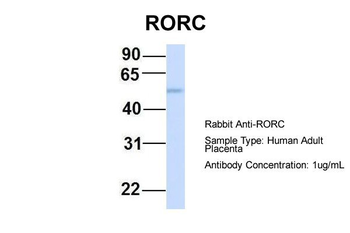 RORC Rabbit Polyclonal Antibody