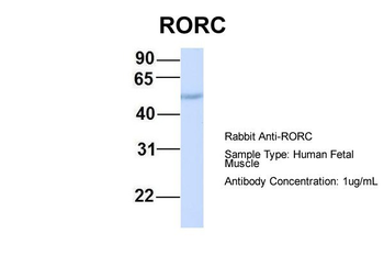 RORC Rabbit Polyclonal Antibody