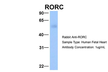 RORC Rabbit Polyclonal Antibody