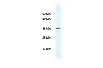 RORC Rabbit Polyclonal Antibody