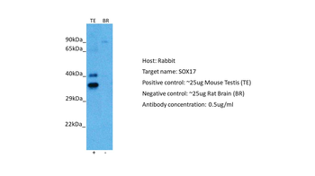 SOX17 Rabbit Polyclonal Antibody