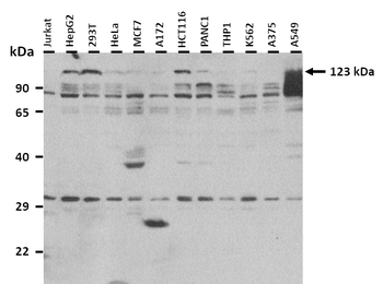 SMARCC1 Rabbit Polyclonal Antibody