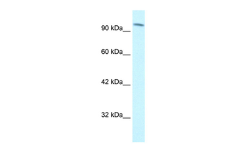 SMARCC1 Rabbit Polyclonal Antibody