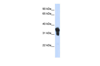 MLX Rabbit Polyclonal Antibody