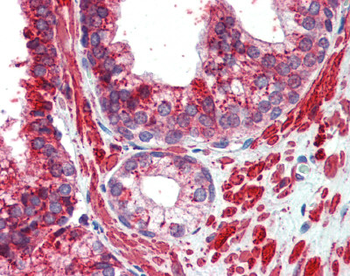 TFAP2C Rabbit Polyclonal Antibody