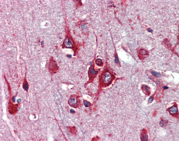 TFAP2C Rabbit Polyclonal Antibody