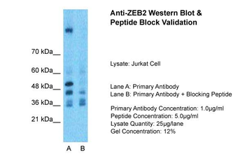 ZEB2 Rabbit Polyclonal Antibody