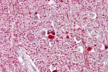 ZEB2 Rabbit Polyclonal Antibody