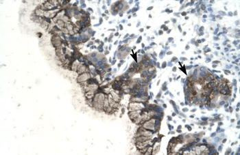 PARP3 Rabbit Polyclonal Antibody
