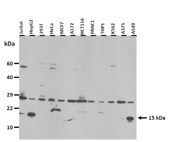 FABP4 Rabbit Polyclonal Antibody
