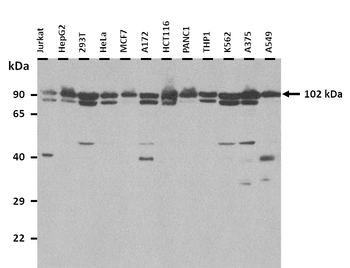 SLC4A1 Rabbit Polyclonal Antibody