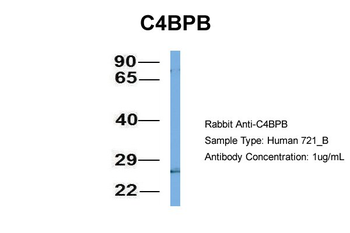 C4BPB Rabbit Polyclonal Antibody