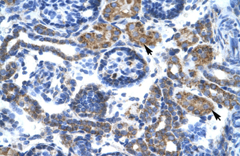C4BPB Rabbit Polyclonal Antibody