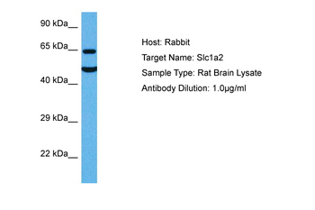 SLC1A2 Rabbit Polyclonal Antibody