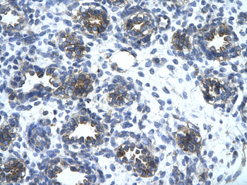 SLC1A2 Rabbit Polyclonal Antibody