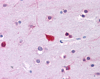 FABP4 Rabbit Polyclonal Antibody