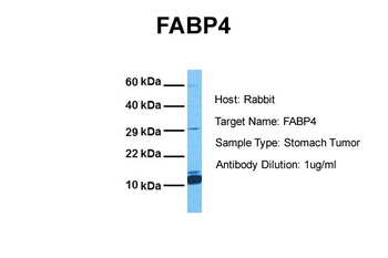 FABP4 Rabbit Polyclonal Antibody