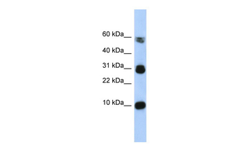 FABP4 Rabbit Polyclonal Antibody