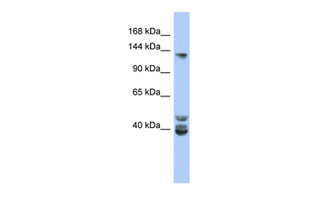 NCOA1 Rabbit Polyclonal Antibody
