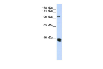 HDAC4 Rabbit Polyclonal Antibody