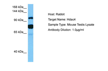 HDAC4 Rabbit Polyclonal Antibody
