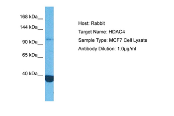 HDAC4 Rabbit Polyclonal Antibody