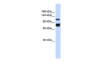 HDAC4 Rabbit Polyclonal Antibody