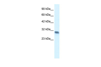 FHL2 Rabbit Polyclonal Antibody