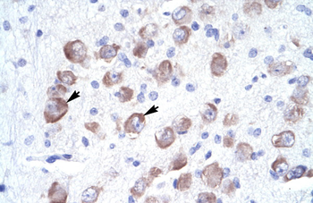 LARP2 Rabbit Polyclonal Antibody