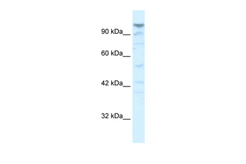 LARP2 Rabbit Polyclonal Antibody