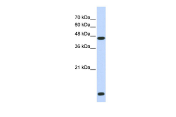 HDAC8 Rabbit Polyclonal Antibody