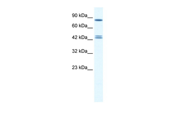 CBX8 Rabbit Polyclonal Antibody