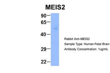 MEIS2 Rabbit Polyclonal Antibody